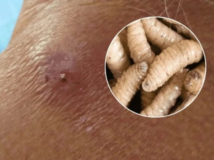 alerta-en-chiapas-gusano-barrenador-llega-a-humanos-657259