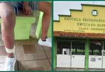 Perros pitbull entran a secundaria de Minatitlán y atacan a estudiantes; hay 7 heridos