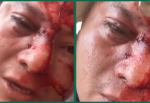 Dan brutal golpiza a activista en Las Choapas